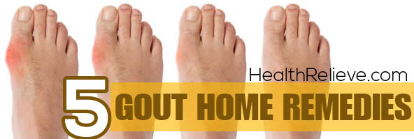 5 Simples Gout Home Remedies